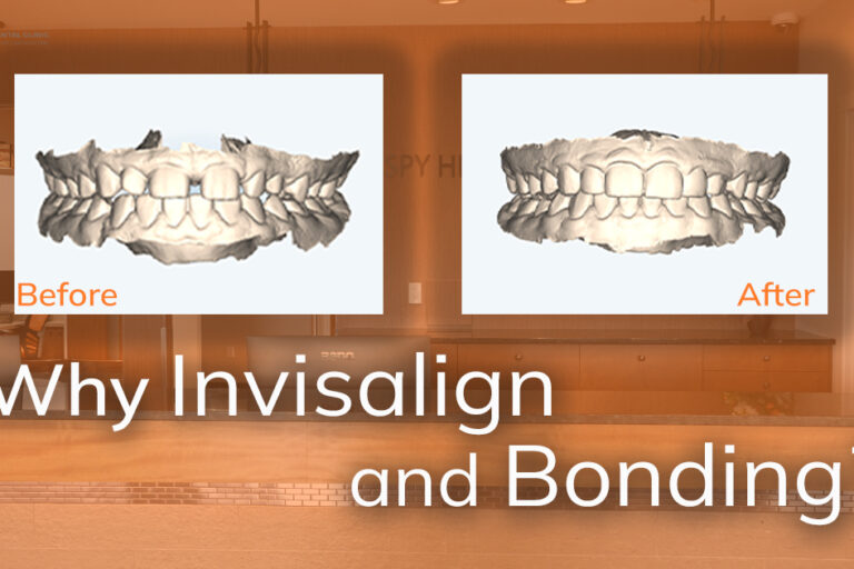 Kolen_Blog-November-24